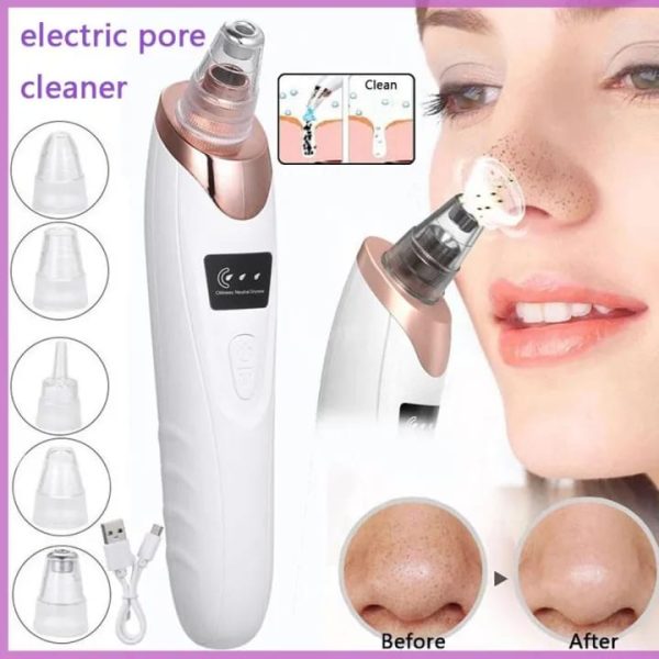Nose & Face Electric Vacuum Suction Blackhead Remover Pore Cleaner