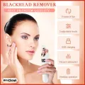 Nose & Face Electric Vacuum Suction Blackhead Remover Pore Cleaner